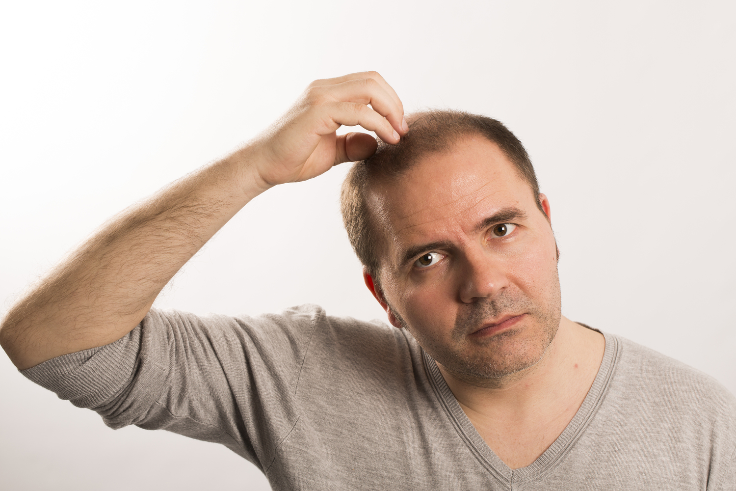 An Essential Guide To Understanding Male Pattern Baldness