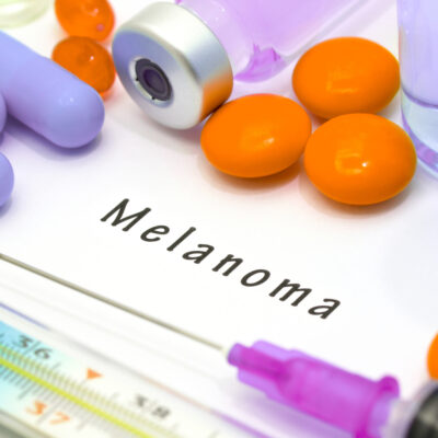 Risk Factors and Prevention of Melanoma