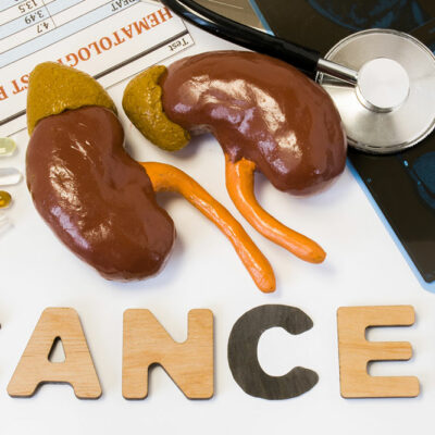 Symptoms and Risk Factors for Kidney Cancer