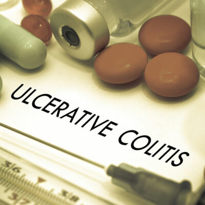 Tips to Prevent Ulcerative Colitis Flare-Ups