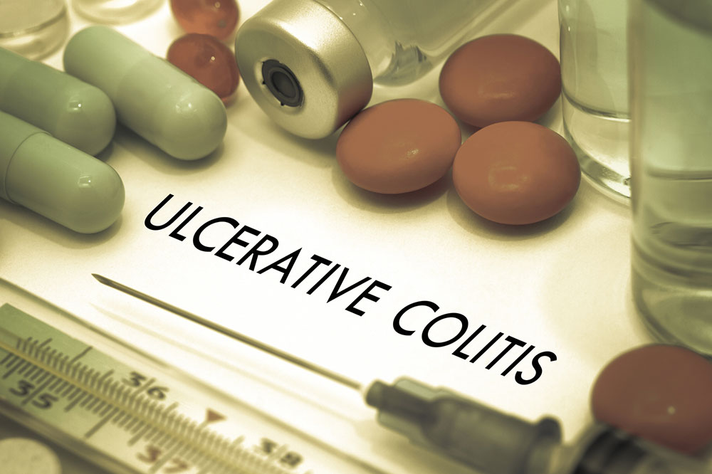 Tips to Prevent Ulcerative Colitis Flare-Ups