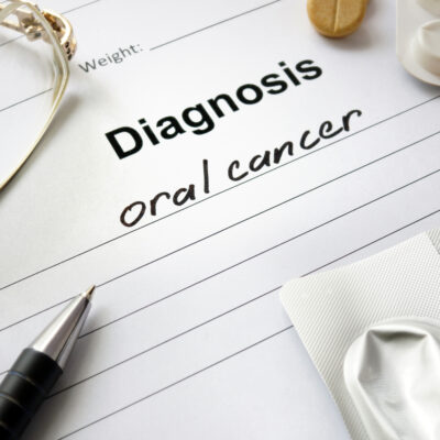 Top Causes, Symptoms, and Treatment Methods for Oral Cancer