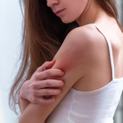 Common Causes of Itchy Skin