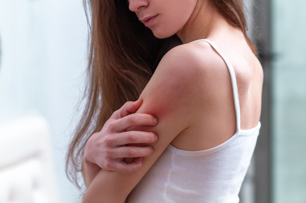 Common Causes of Itchy Skin